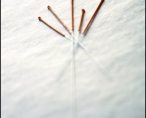 product-needle-healthcare-alternative-accupunture Michael LoBiondo Photography - Accupunture needles displayed on surface